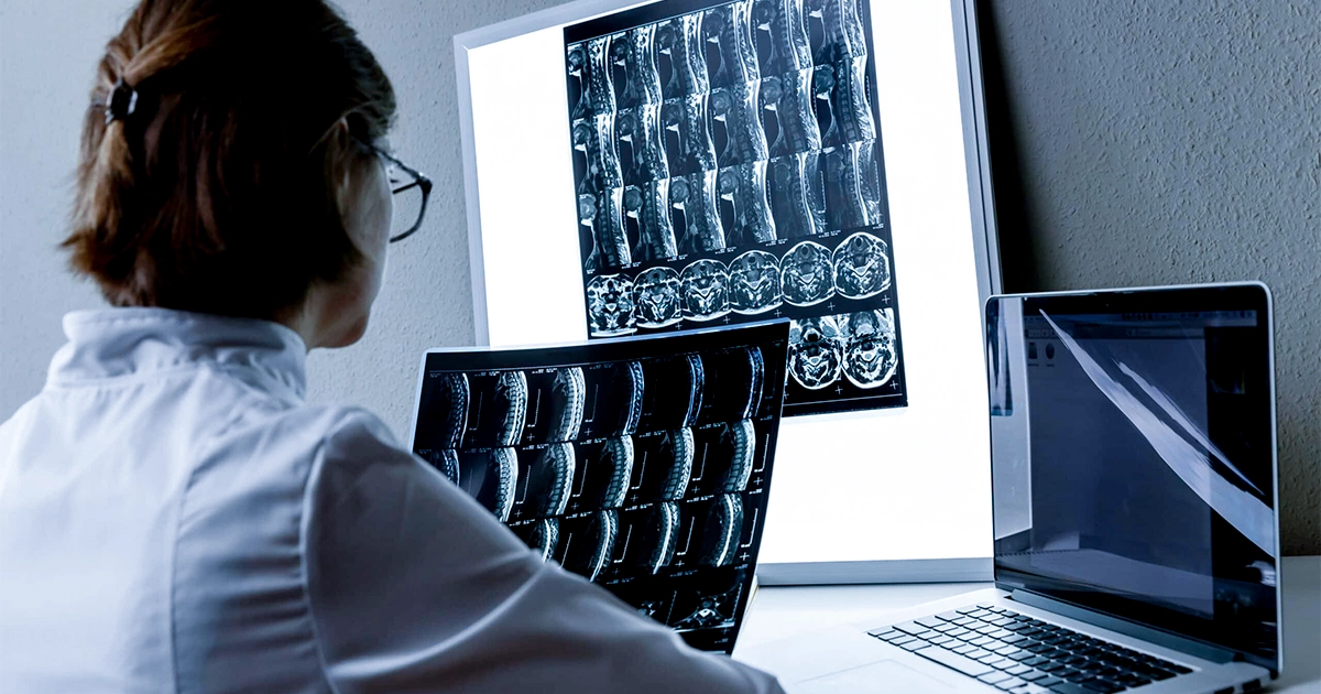 How Does a Spinal Cord Injury Affect the Brain?